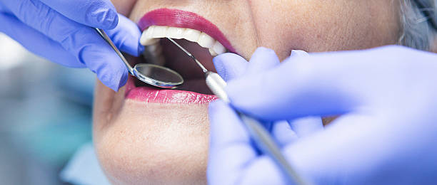 Best Emergency Tooth Extraction  in Schler Park, IL